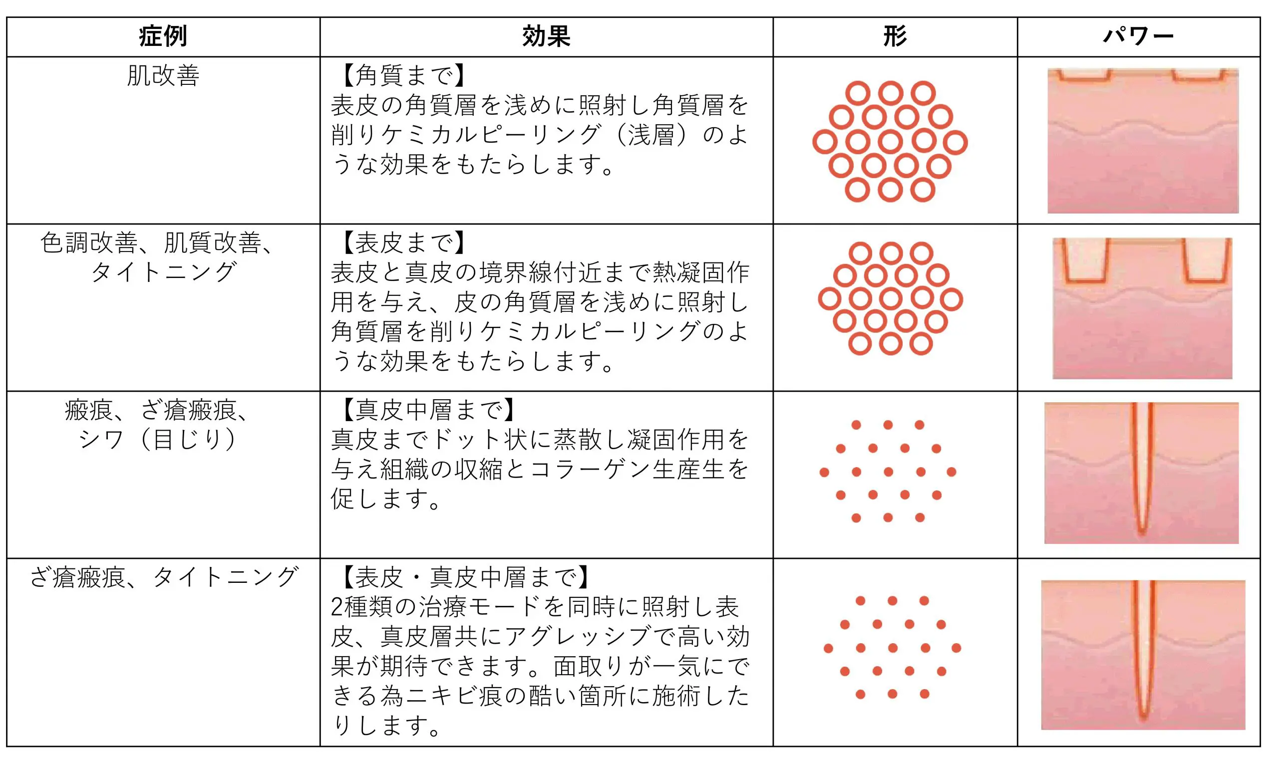 レーザー ストア ピーリング 種類